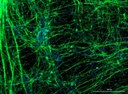 Fapesp - corona neuronios.jpg