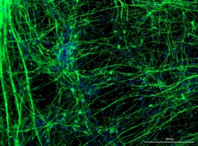 Fapesp - corona neuronios.jpg