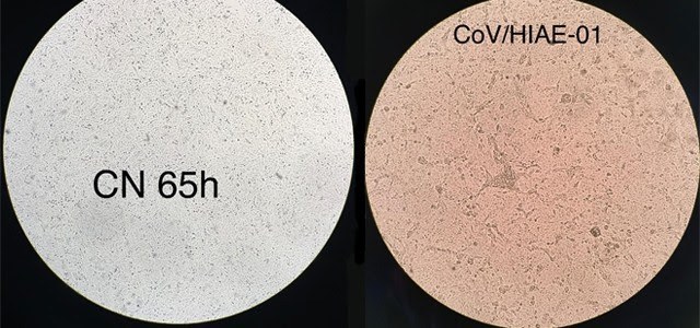 FAPESP - coranavirus em lab.jpg